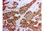 Novodiax - Model CK 8/18 Ab - Rapid IHC Panel
