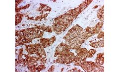 Novodiax - Model CK 8/18 Ab - Rapid IHC Panel