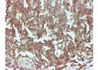 Novodiax - Model CD45 Ab - Rapid IHC Panel
