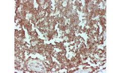 Novodiax - Model CD45 Ab - Rapid IHC Panel
