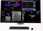 Odyssey Vision - Electrophysiology (EP) System