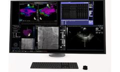 Odyssey Vision - Electrophysiology (EP) System