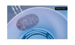 Reducing Oral Mucositis - Video