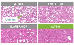 Model ALT-801 - Dual GLP-1/Glucagon Agonist For NASH