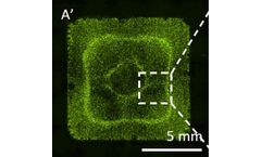 Acoustic Bioprinter for Bridging from Bench to Bedside