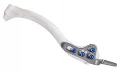 Clavicle Xloc - Anatomically Shaped Hook Plate