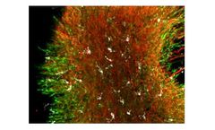 Stem Pharm - Advanced Neural Organoids Models
