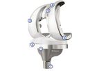 Medacta - Model GMK- Primary - Total Knee System