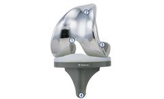 Medacta - Implant Total Knee System