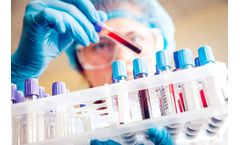DCNovations - Model MATL-15 - Blood Collection/Separation Materials Kit