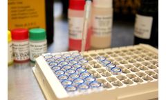 Assay Development Services