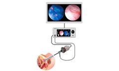 Cystoscopy with the i/Blue Imaging System
