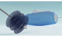 Okami Medical LOBO Vascular Occlusion System - Video