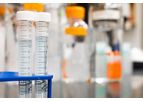 cfDNA Extraction Specificity Controls