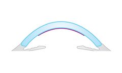 Model DMEK - Descemet’s Membrane Endothelial Keratoplasty