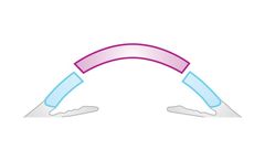 Model PKP - Penetrating Keratoplasty