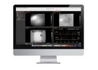 Inscopix - Software Solutions for Miniscope Imaging