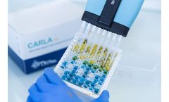 Microbia - Prediction of Toxigenic Blooms with the CARLA Technology