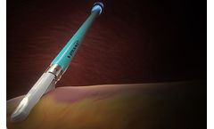 Voyant - Model 5mm - Fusion Device