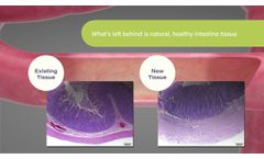 The Eclipse XL1 - Eclipse Regenesis - Video