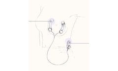 nfant - Thrive Breast Sensor