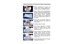 Synthasome - X-Repair Technology - Brochure