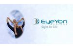 EyeYon Medical Company Overview - Video