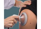 LymphaTouch -Medical Device for Professionals