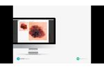 DermEngine for Intelligent Dermatology - Video
