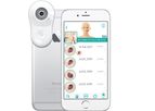 MoleScope - Model II - Mobile Dermatoscope