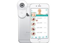 MoleScope - Model II - Mobile Dermatoscope