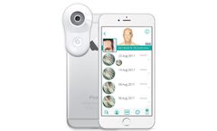 TrikoScope - Trichoscopy Device