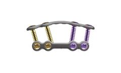 Lapiplasty Biplanar - Model SK14 - Plating Kit