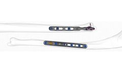 Freefix - Ulnar Shortening System