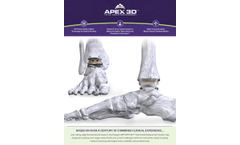 APEX 3D - Total Ankle Replacement System - Brochure