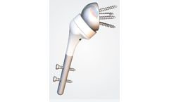 Humelock Reversed - Trauma Reverse Prosthesis