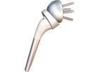 Humeris Reversible - Convertible Shoulder Prosthesis