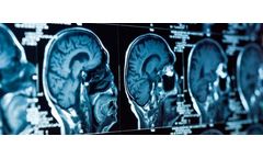 Diagnostic Imaging