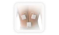 C-Scan - Track System