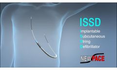 NewPace issd cn - Video