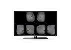 QView Medical - Model QVCAD - CAD System for 3D Automated Breast Ultrasound