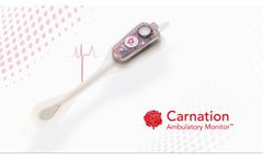 CAM - Short Introduction - Video