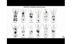 SNMMI Henry N. Wagner, Jr., Image of the Year - Video
