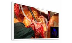 CuratOR - Model EX5841 - 58-Inch Widescreen Surgical Monitor