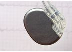 Cardiac Rhythm Management Devices