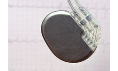 Cardiac Rhythm Management Devices