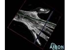 aiSon 3D - Ultrasound Device