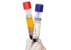 RegenATS - Model PRP - Leukocyte-Reduced Platelet Gel
