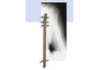 Humerus Interlocking Nail System