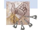 Distal Radius Plate System